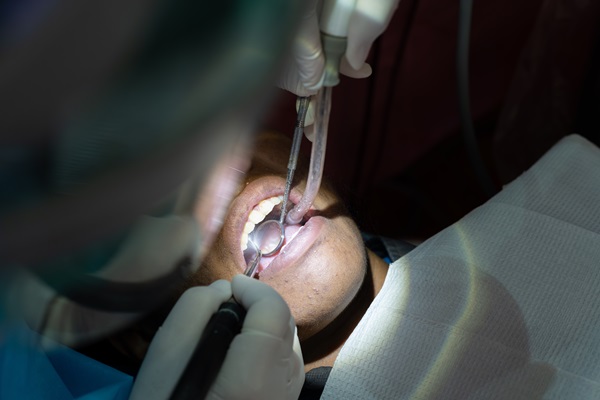 Can A Deep Dental Cleaning Treat Gum Disease?